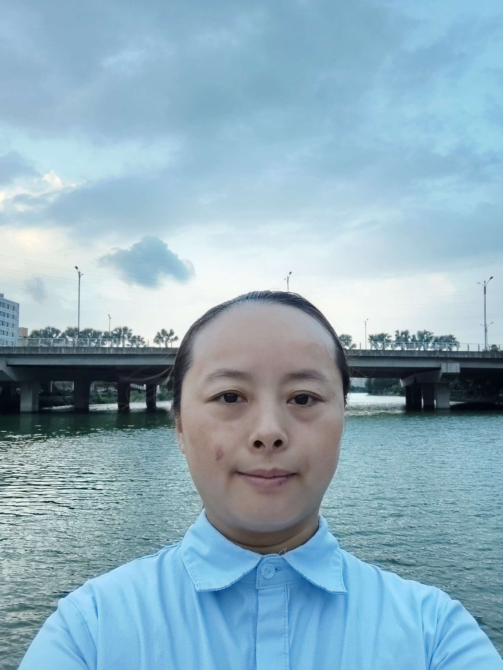 有哪些长辈，亲朋好友还记得我脸上独一无二的胎记呢？ - 石秀