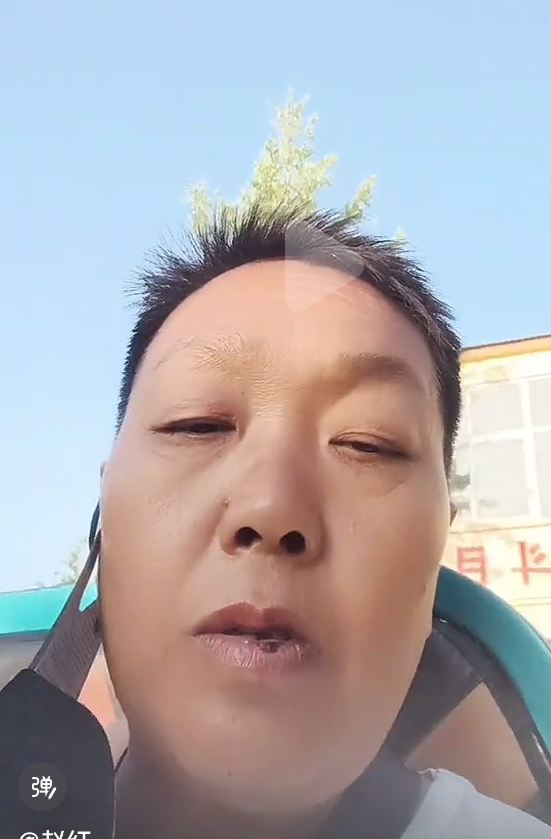 这是我的母亲，走路左脚有问题和脑袋有点问题 - 赵红社